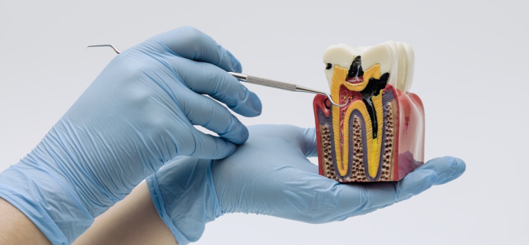 Odontología General en Andoain