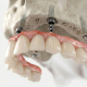 dientes en 1 día